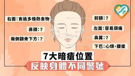 眉暗瘡位置|暗瘡位置反映身體問題｜中醫拆解13個部位：下巴、眉 